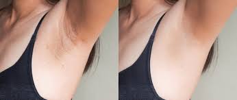 Le produit Coréen Snow Bleach